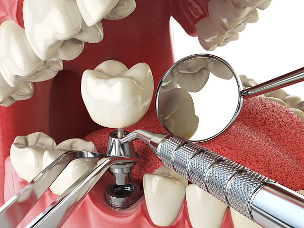 Best Emergency Orthodontic Repairs in Holton, KS