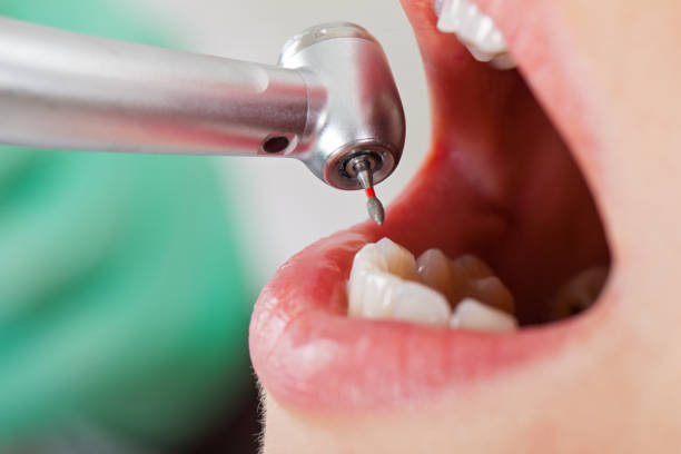 Best Broken or Chipped Tooth Repair in Holton, KS